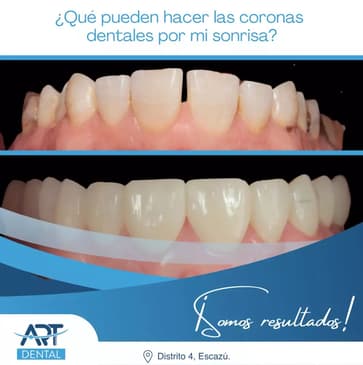 Slider image (10) Art Dental Care
